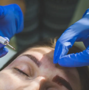This Woman Got A Horrible Infection After Getting Her Eyebrows Microbladed By Shauna Magrath